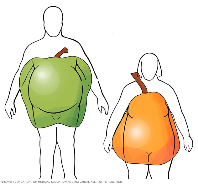 Cuerpos con forma de manzana y de pera
