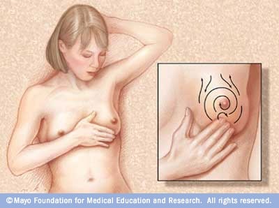 Illustration demonstrating breast self-exam 
