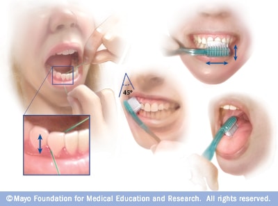 Collage fotográfico: limpieza con cepillo e hilo dental para la salud bucal 
