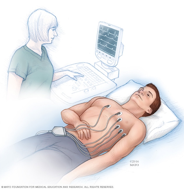 心电图（ECG 或 EKG）