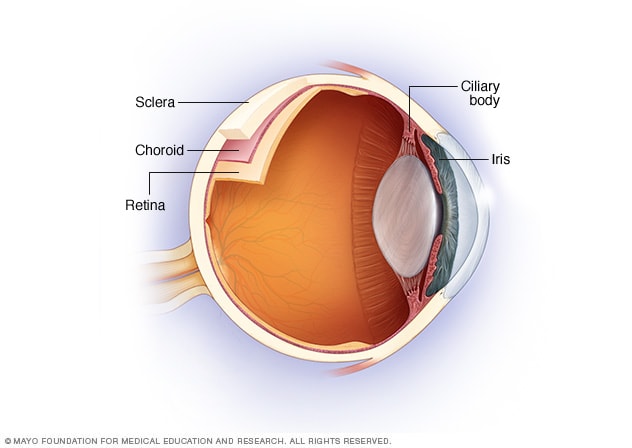 عنبية العين حيث يحدث التهاب عنبية العين
