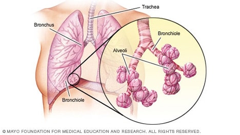 Ilustración de bronquios, bronquiolos y alvéolos
