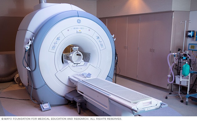 فحص التصوير بالرنين المغناطيسي (MRI) للدماغ