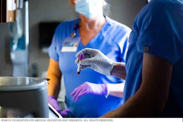 Un técnico con la mano enguantada sostiene una muestra de sangre entera en un tubo de recolección de sangre.