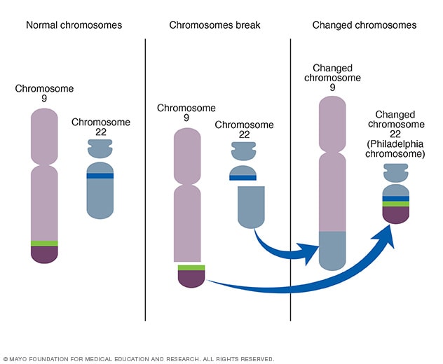Creación del cromosoma Filadelfia