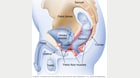 Where pelvic floor muscles are located in men