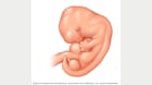 受孕 5 周后的胚胎 