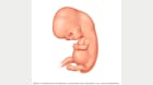 受孕 7 周后的胚胎