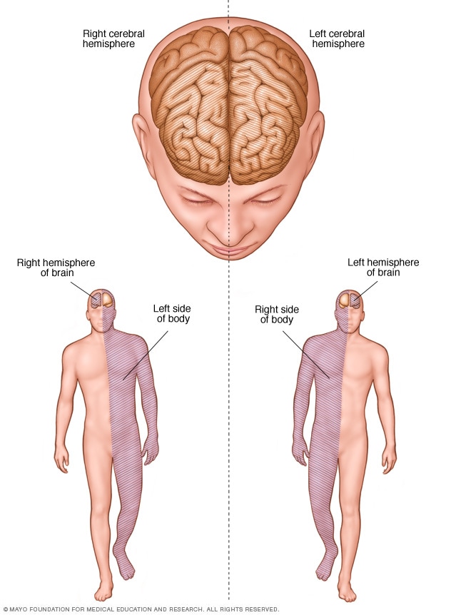 Conexiones de los hemisferios cerebrales