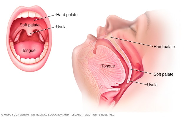 Partes de la boca, inclusive el paladar blando, el paladar duro, la úvula y la lengua.