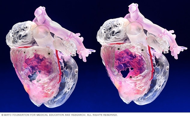 En la educación médica, se utilizan modelos impresos en 3D del corazón y de las partes relacionadas con el sistema vascular